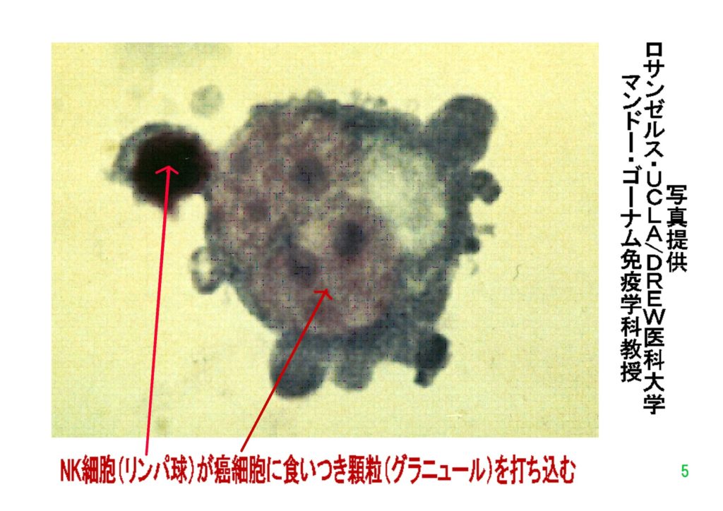 食べ過ぎで癌に きせんワールド